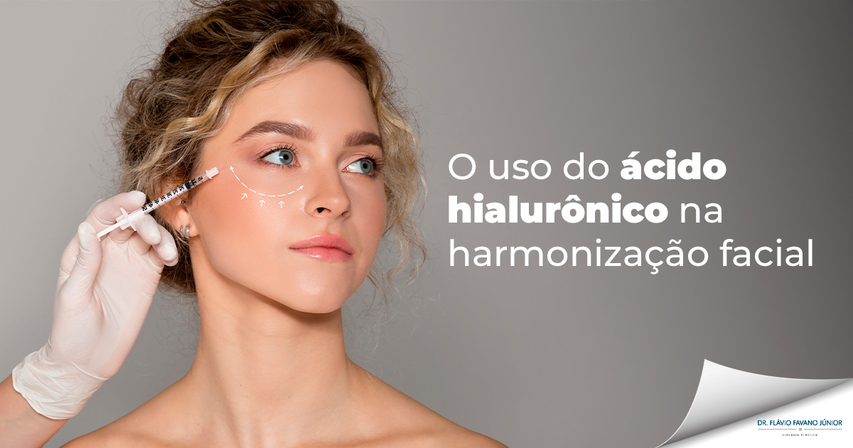 Ácido hialurônico na harmonização facial