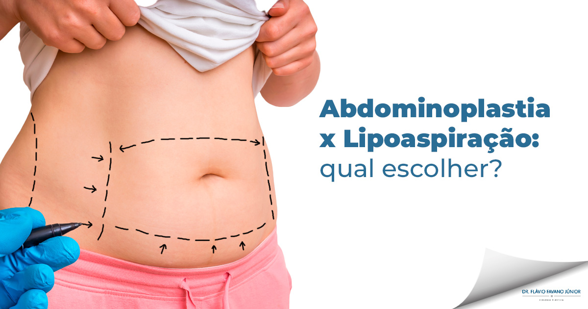 Abdominoplastia e lipoaspiração: quais as diferenças?