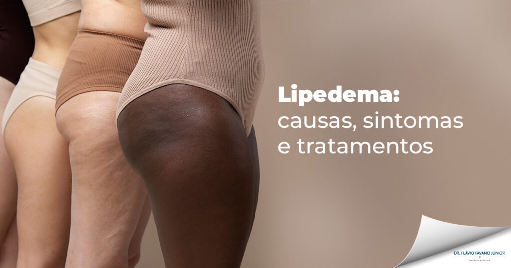 Imagem mostrando várias mulheres com lipedema nas pernas