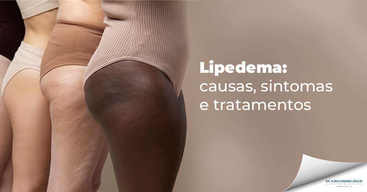 Lipedema: tudo o que você precisa saber