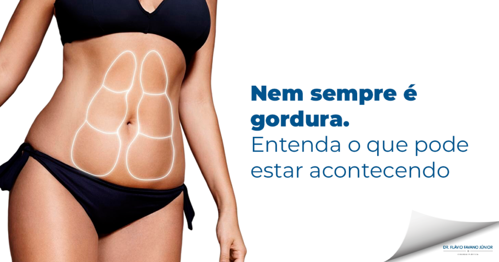 diástase abdominal