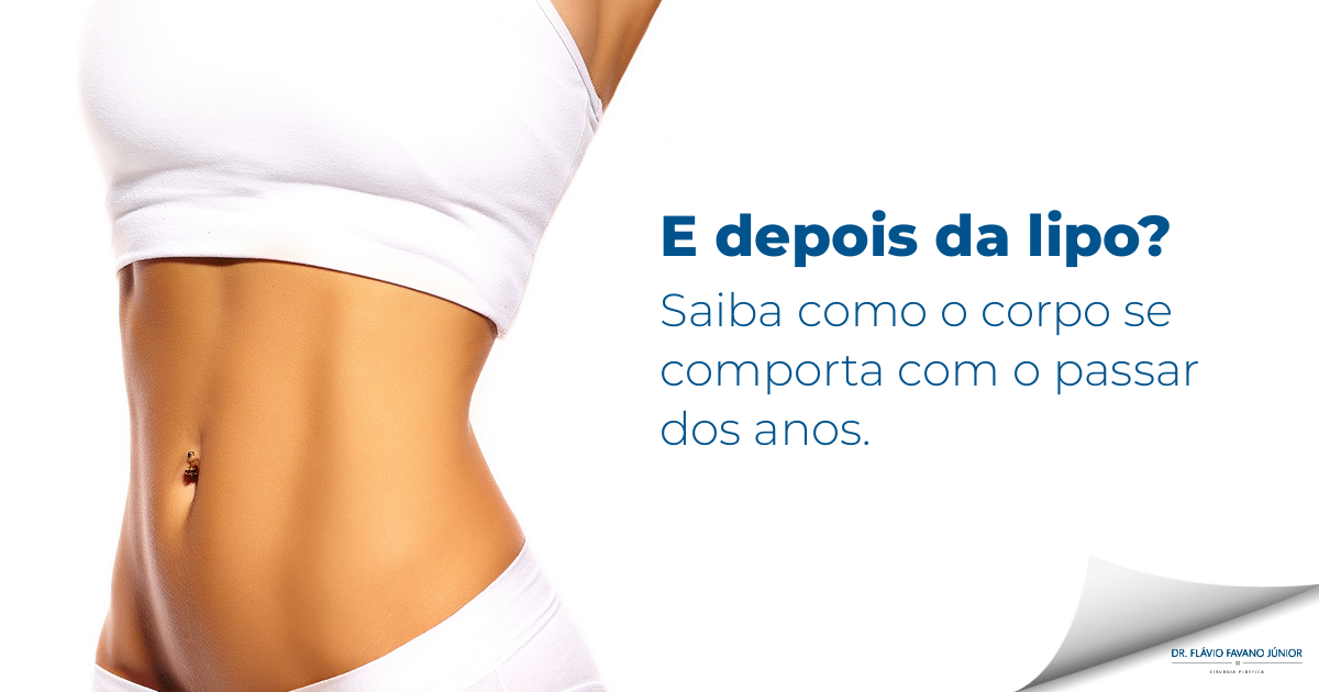 A gordura volta depois da lipoaspiração? Entenda o que acontece com o corpo nos anos seguintes